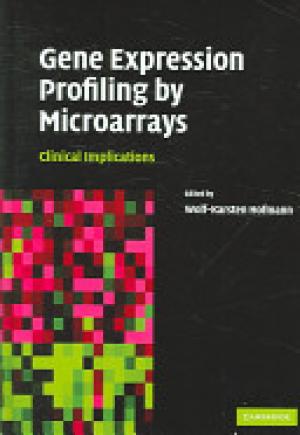 Gene Expression Profiling by Microarrays