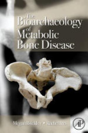 The Bioarchaeology of Metabolic Bone Disease